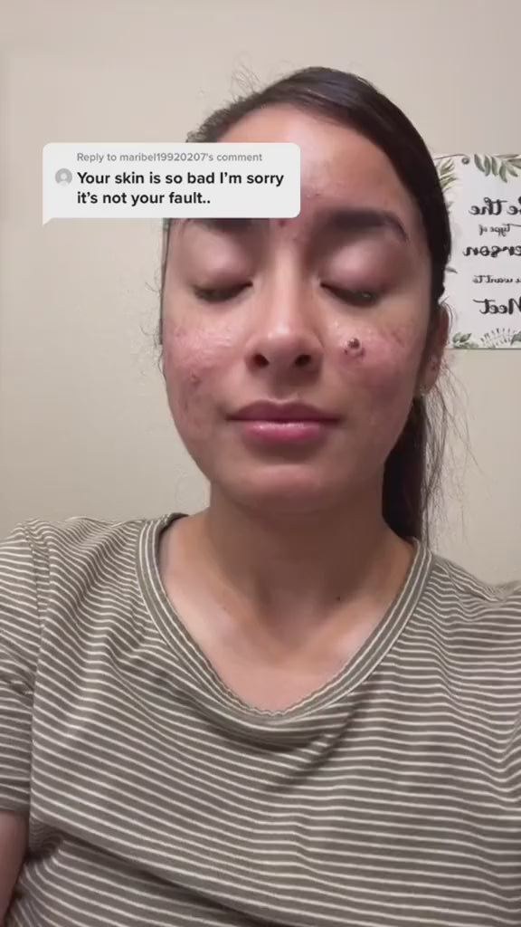 Snail 96 Mucin Power Essence 100 Ml